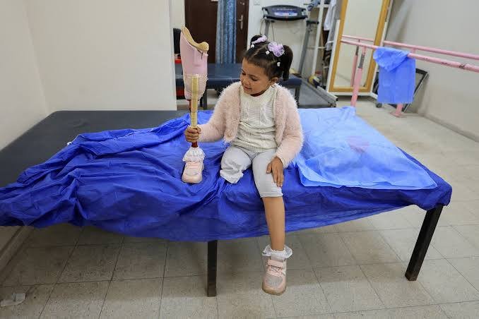 Hamad Hospital’s Director General for Rehabilitation and Prosthetics, Hamad Naim reports: Gaza is now home to 8,000 amputees, 25% of them children. 12.5% women.