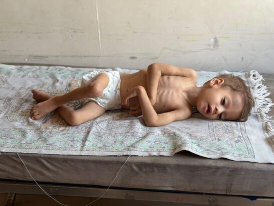 Gaza isn’t able to recover from famine as acute malnutrition soars across the Strip, new report finds Gaza isn’t able to recover from famine as acute malnutrition soars across the Strip, new report finds