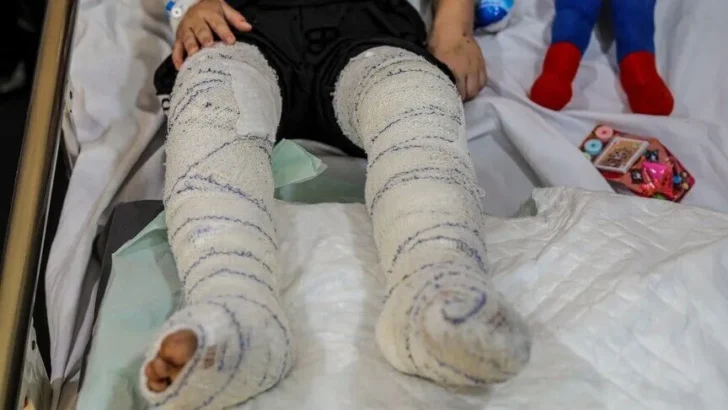 Palestinian child unconscious, faces possible foot amputation after Israeli detention: NGO